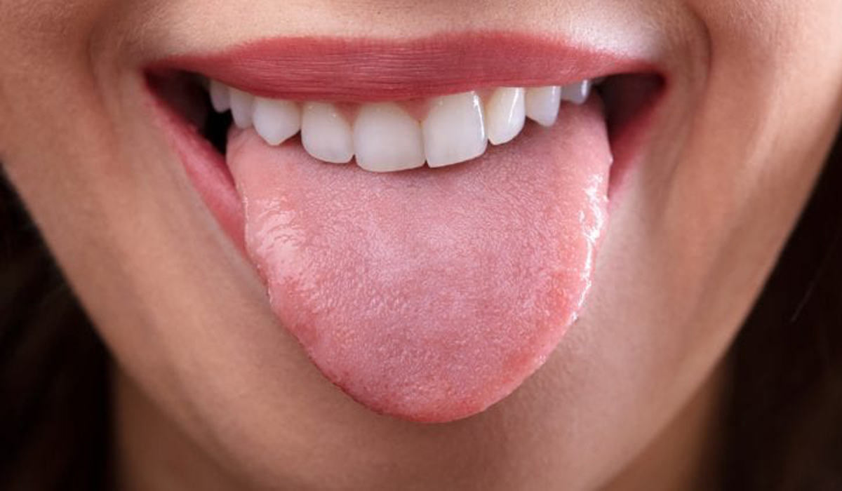 Pimples Under Tongue-Shocking Things You Need to Know